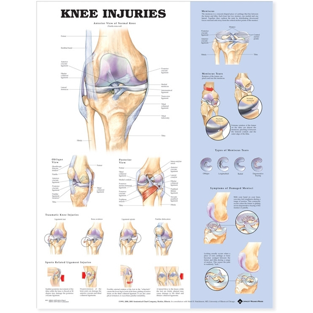 Knee Injuries Anatomical Chart