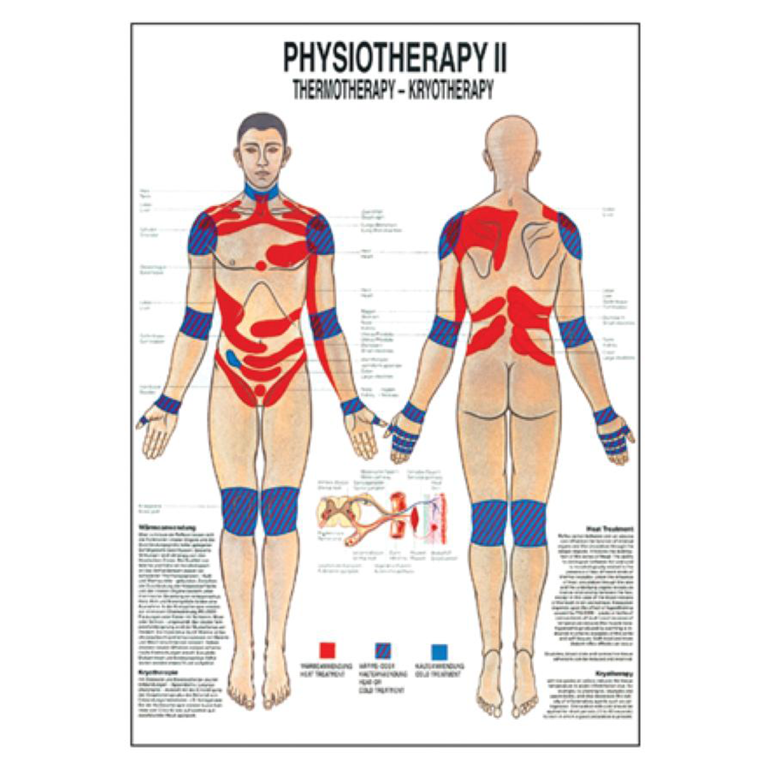 Thermotherapy Chart